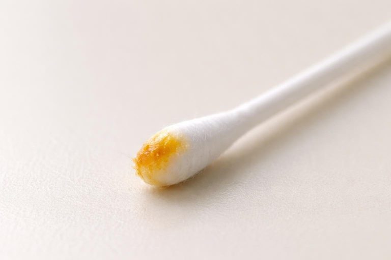 À Quoi Ressemble un Bouchon de Cérumen : Aspect et Couleur