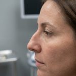 Pourquoi ai-je une bosse sur le nez et comment la corriger ?