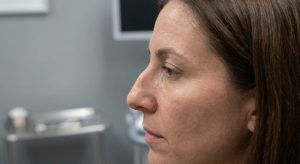 Pourquoi ai-je une bosse sur le nez et comment la corriger ?